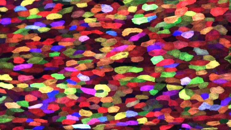 看起來很像印象派的筆觸？其實是陳振輝團隊研發的 Skinbow 多顏色標誌工具，用來研究斑馬魚修復傷口和再生複雜組織過程中，表皮細胞如何運作。圖片來源│陳振輝實驗室網站
