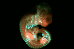 顯微鏡下的小鼠胚胎，發著綠光的線條是中樞神經系統神經元的軸突。 圖│陳俊安提供