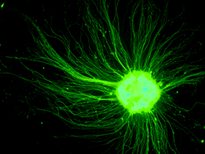 陳俊安團隊從小鼠胚胎幹細胞 (ES cell) 培養的運動神經細胞。在培養皿中沒有肌肉可抓，運動神經元的軸突四處延伸。 圖│陳俊安提供