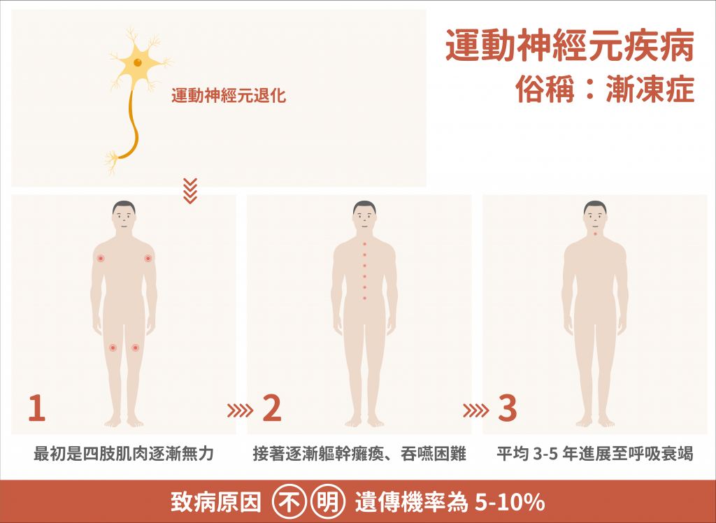 運動神經元疾病 (motorneuron diseases) 俗稱「漸凍症」,其特性與症狀發展。圖│研之有物 (資料來源│中華民國運動神經元疾病病友協會 / 漸凍人協會)