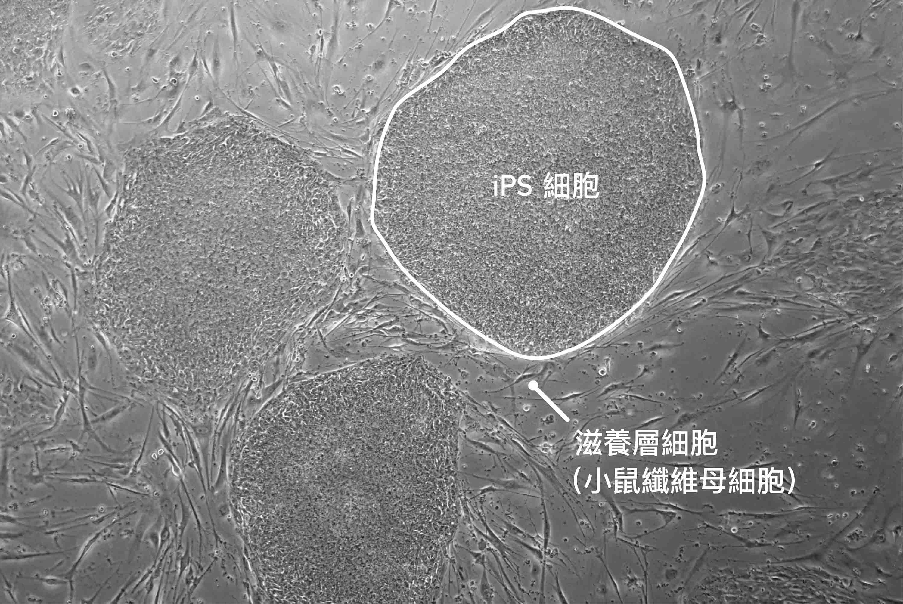 顯微鏡下的 iPSC 。小鼠胚胎纖維母細胞的功能是為了提供 iPSC 所需的生長環境 ，維持 iPSC 的不分化狀態。圖│誘導型多潛能幹細胞 (iPSC) 核心實驗室