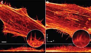 左圖為陳壁彰團隊運用晶格層光照射的海拉細胞二維影像，右圖是一般貝索光束。可以見到晶格層光能取得較細緻的結構成像。圖│Chen, B. C., Legant, W. R., Wang, K., Shao, L., Milkie, D. E., Davidson, M. W., … & English, B. P. (2014). Lattice light-sheet microscopy: imaging molecules to embryos at high spatiotemporal resolution. Science, 346(6208), 1257998.
