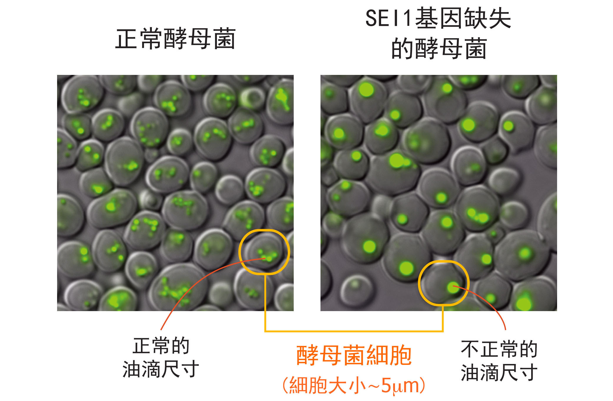 左圖為正常酵母菌細胞，右圖為酵母菌單一基因 SEI1 的突變株，右圖明顯可見：細胞中綠色部分標示的油滴尺寸變大、且數量變少。圖│王昭雯