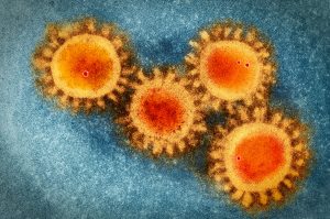 新冠病毒在電子顯微鏡下的影像，表面突起的棘蛋白，是它們進攻細胞的重要武器。圖片來源│iStock
