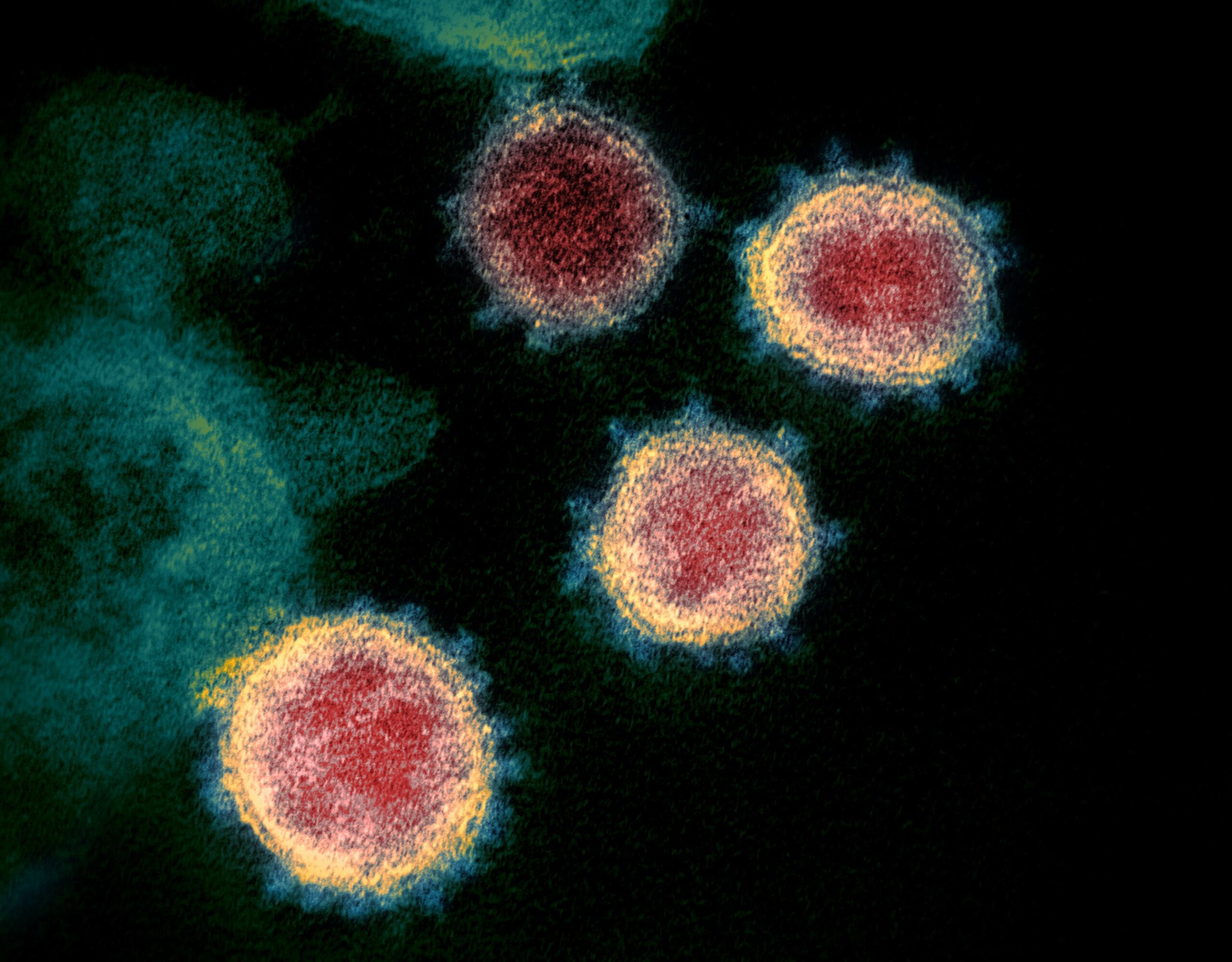 新冠病毒在穿透式電子顯微鏡下現形，可見病毒表現突起的棘冠。因新冠病毒是 RNA 病毒，突變速度快。中研院團隊將目前新冠病毒變異分為六大類型，目前全球流傳的幾乎都是第六類型病毒，未來團隊將持續追蹤病毒變異。圖│維基百科