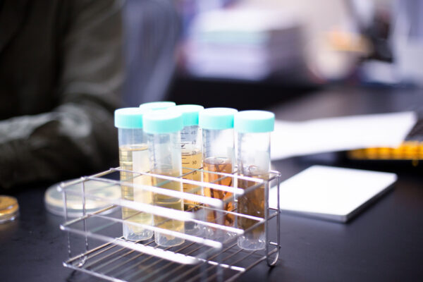 蔡怡陞實驗室中，放入培養液和樣本的6支試管。培養液相當重要，負責讓低調但無處不在的釀酒酵母現身。 圖│研之有物