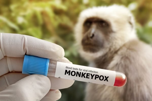 2022 年的猴痘疫情是繼 2020 年新冠肺炎疫情之後的「國際關注公共衛生緊急事件」。圖｜iStock